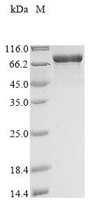 [0399-CSB-EP015299HU-20UG] Recombinant Human Myosin-6 (MYH6), partial (160-816aa), N-terminal 10xHis-tagged, E.coli expression - 20 ug