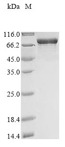 Recombinant Human Myosin-6 (MYH6), partial (160-816aa), N-terminal 10xHis-tagged, E.coli expression - 20 ug