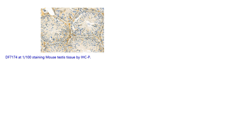 Peroxiredoxin 3 (PRDX3) polyclonal Antibody - 200 uL