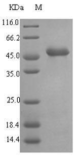 [0399-CSB-EP318584EZX-20UG] Recombinant Pseudomonas aeruginosa Elastase (lasB) - 20 ug